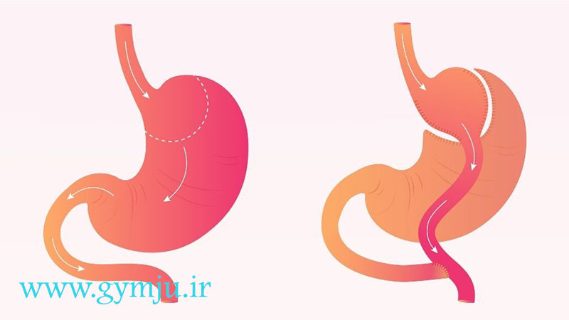  تغییرات آناتومیکی بر تغذیه