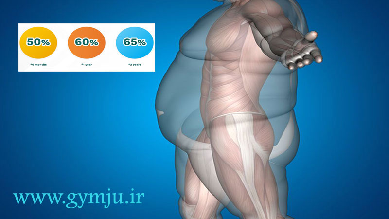 آمار موفقیت در جراحی لاغری