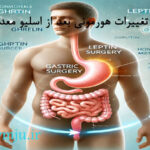 تغییرات هورمونی بعد از اسلیو معده