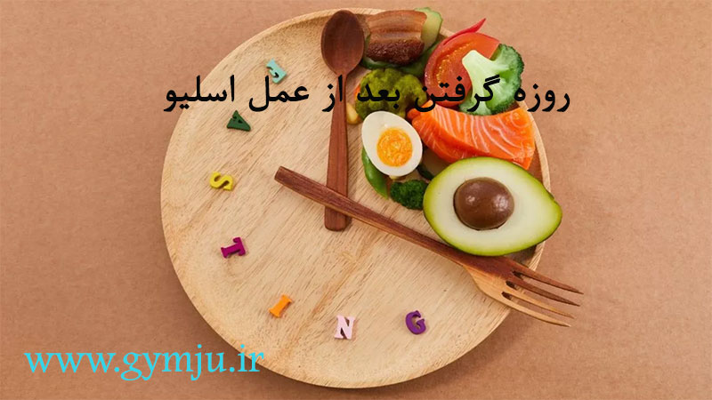 روزه گرفتن بعد از عمل اسلیو